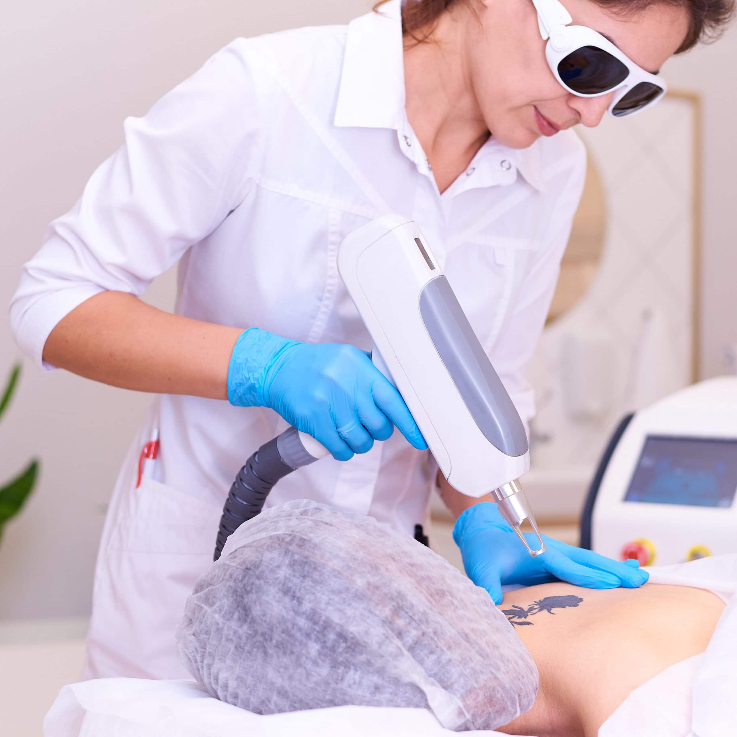 Laser tattoo removal procedure at Elevate Training Academy, with a professional technician using advanced laser technology on a client's tattoo.